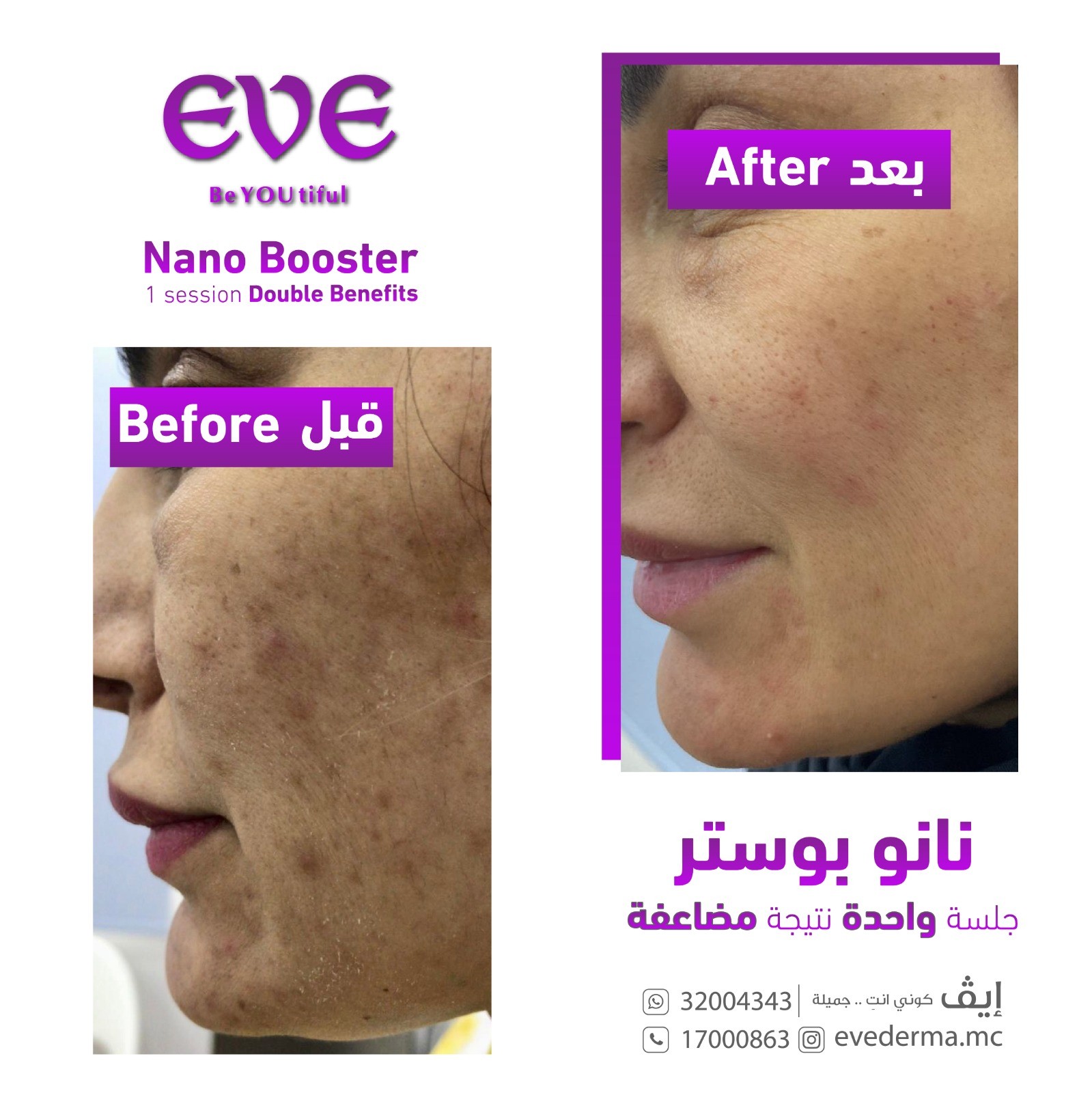 Exclusive in EVE - Nano Booster 1 session Double Benefits